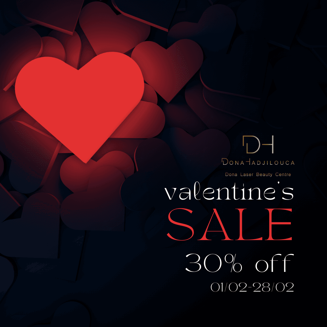 Valentines Offer 2025 – Terms & Conditions